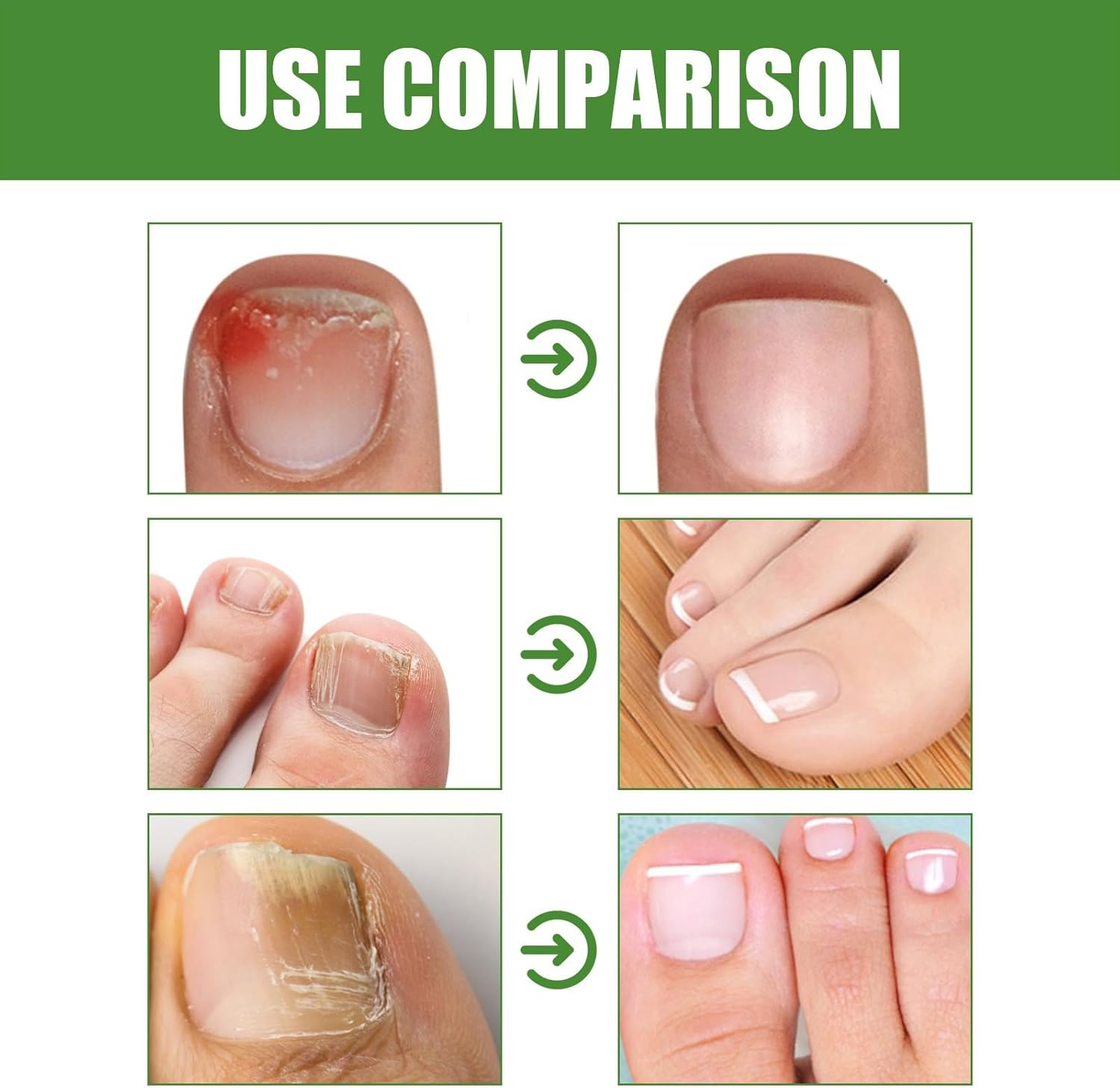 Anti-Fungal Stick | DRMODE