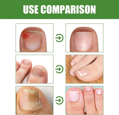 Anti-Fungal Stick | DRMODE